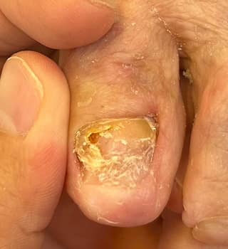 画像の説明を入力 アフター