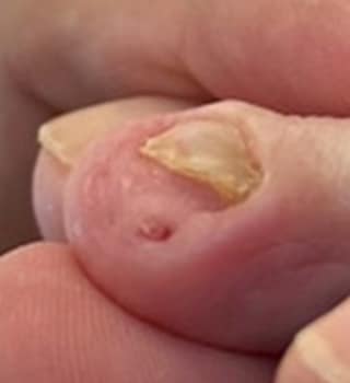 画像の説明を入力 アフター