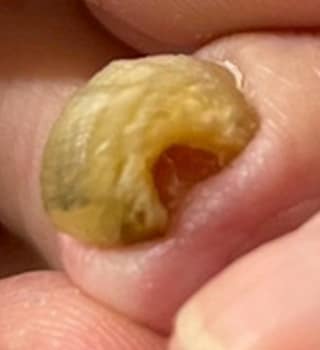 画像の説明を入力 ビフォー