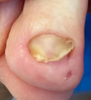 画像の説明を入力 アフター