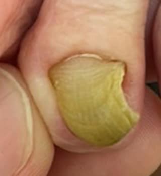 画像の説明を入力 ビフォー