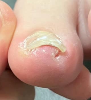 画像の説明を入力 アフター