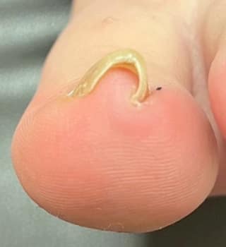 画像の説明を入力 ビフォー