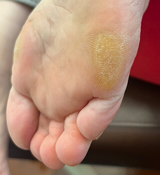 画像の説明を入力 ビフォー